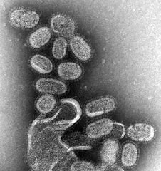 http://s9.picofile.com/file/8276742834/EM_of_influenza_virus.jpg