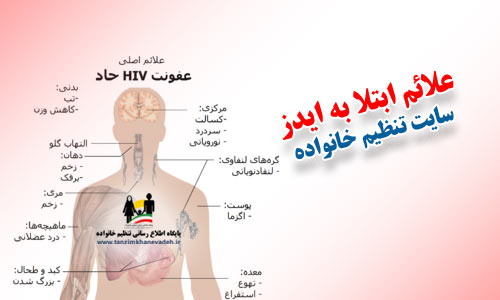 علایم ایدز