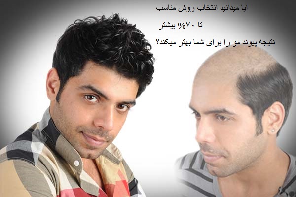 ترمیم مو با بهترین روشهای روز دنیا 100% طبیعی