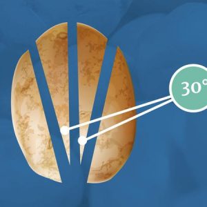 سیب زمینی ترد
