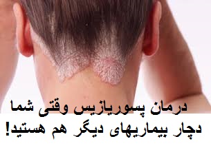 عکس پسوریازیس